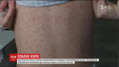 В Киеве корью заболели 12 детей