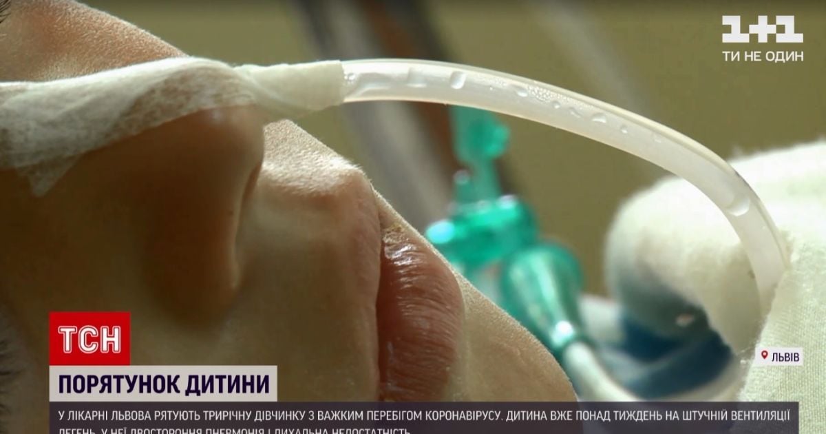 Трехлетней девочке с коронавирусом, которую спасают во Львове, срочно нужна кровь редкой группы