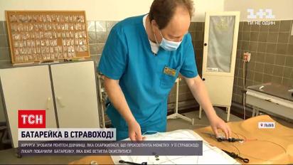 Новини України: у Львівській області дівчинка дістала опік стравоходу через літієву батарейку