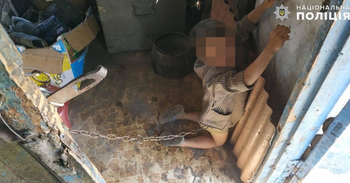В селе на Луганщине отец посадил на цепь 6-летнего сына