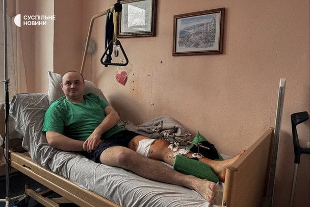 Полицейский офицер общины Александр Шпак, который получил ранения во время перестрелки в селе Нехворощ на Корсунщине / © Суспільне