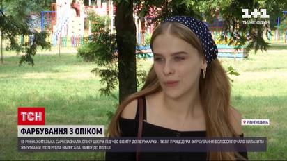 Новини України: опік голови та втрата волосся –жителька Сарн оговтується від візиту до перукарки