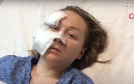 В Турции ревнивый муж порезал ножом лицо 28-летней украинке (видео)