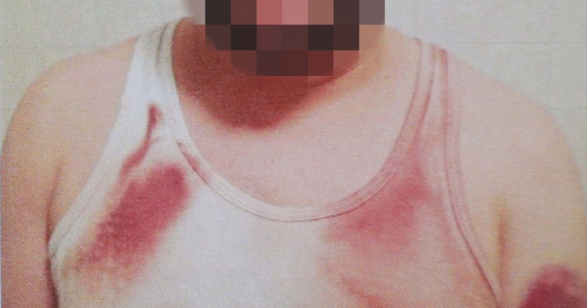 Жорстоке побиття підозрюваного під час затримання: у Києві двом оперативникам повідомлено про підозру