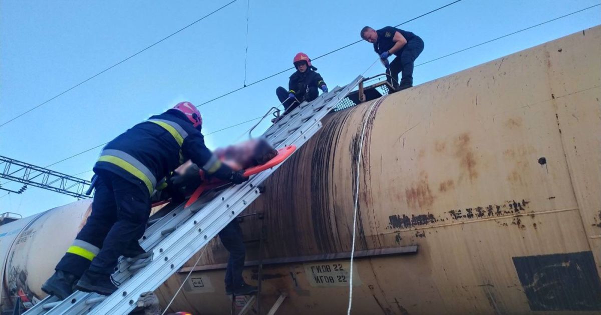 26-летняя девушка получила тяжелые ожоги от удара током из железнодорожной цистерны