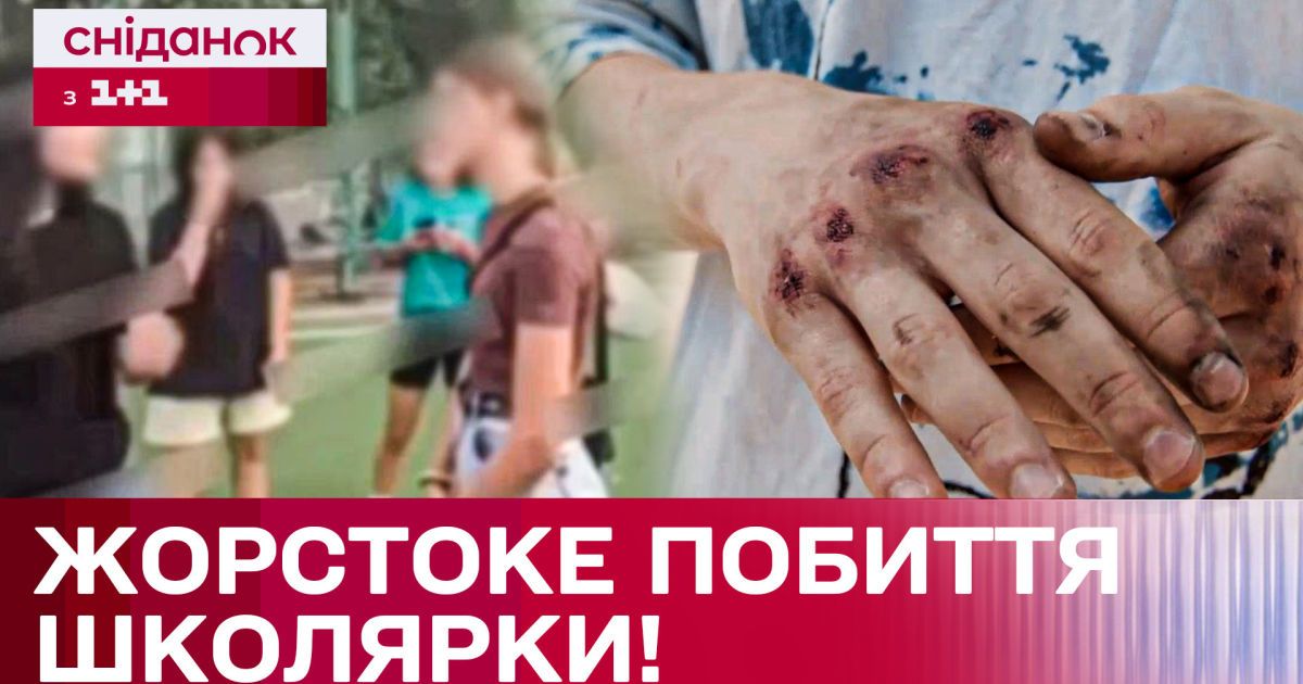 Группой избили девочку! В Киеве расследуют страшный инцидент!