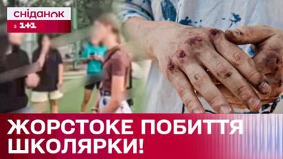 Группой избили девочку! В Киеве расследуют страшный инцидент!