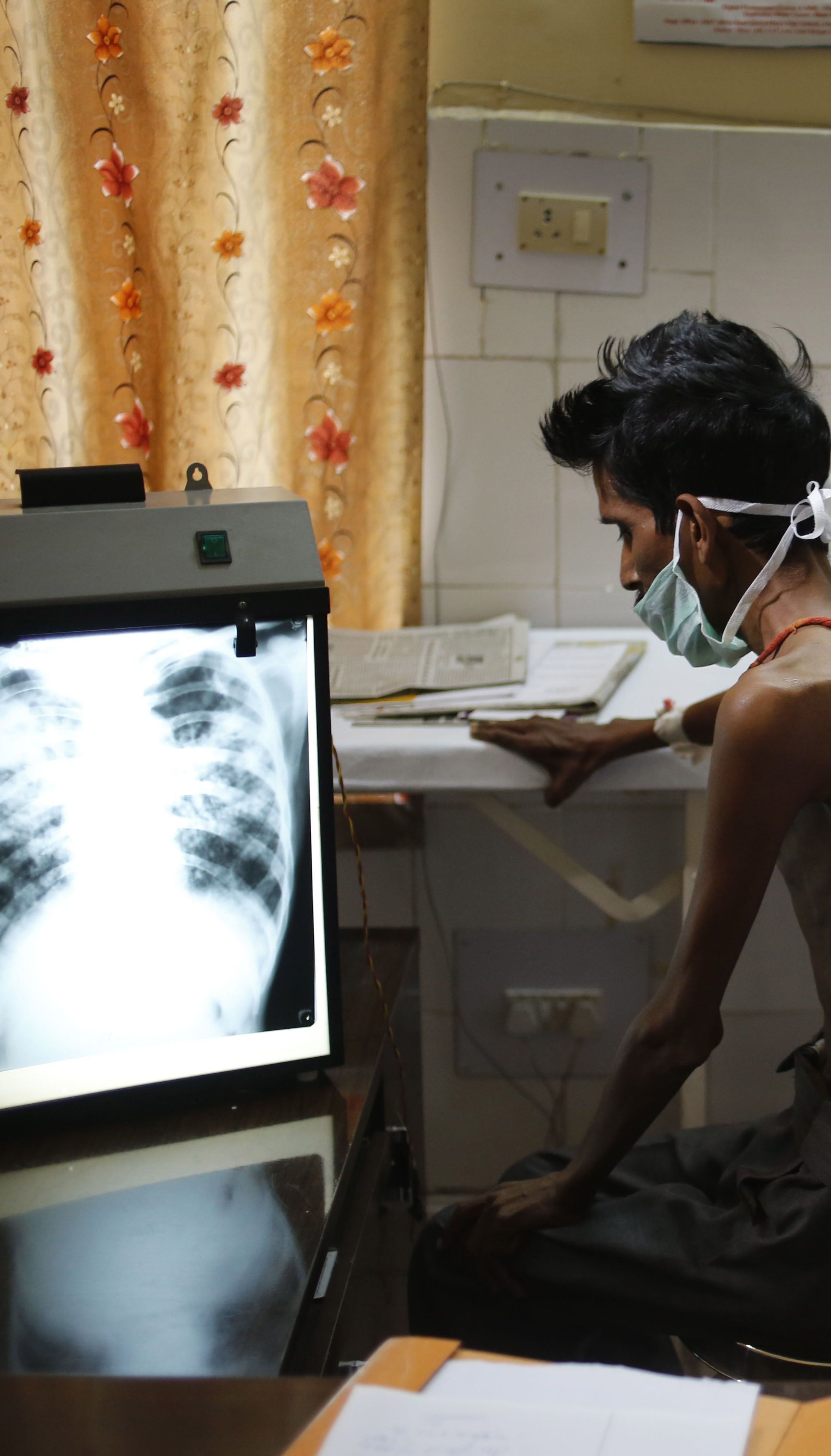 Из-за коронавируса необнаруженные случаи туберкулеза угрожают новой эпидемией — ВОЗ