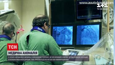 Новости мира: в Израиле родилась девочка с близнецом в желудке
