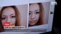 Новое лицо для детей: как хирурги в Украине убирают страшные пороки и дают шанс на лучшую жизнь