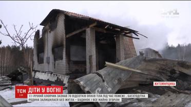 На Житомирщині спалахнув будинок із трьома дітьми в середині, яких залишили вдома самих