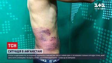 Новости мира: в Афганистане возобновят казни и отрезание рук за кражи