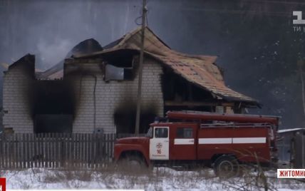 У вкрай важкому стані залишається 11-річний хлопчик, який обгорів у власному будинку на Житомирщині