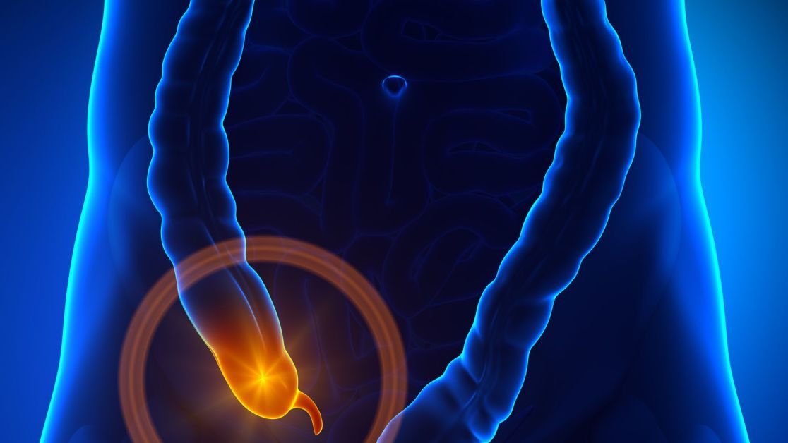 Аппендицит: симптомы, признаки, с какой стороны болит, операция по удалению, как определить