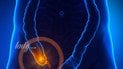 Острый аппендицит: как распознать воспаление и что делать