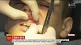 Як повернути на місце вибитий з коренем зуб - рецепт від медиків