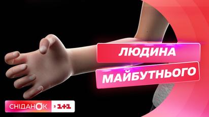 Зайва вага та скручені пальці: як змінить зовнішність дистанційка та як вберегтись від патологій