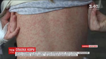 Через спалах кору у Запоріжжі на лікарняних ліжках опинилося одразу 13 дітей