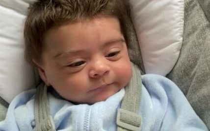 Фото малыша с густой шевелюрой стали вирусными в Сети: почему у ребенка от рождения так много волос