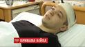 В Краматорске полицейский спас от хулиганов мужчину и получил топором по голове