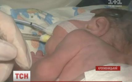 Перинатальный центр в Кропивницком спасает 70% деток, которые родились с весом до килограмма
