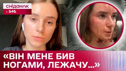 Девушку жестоко избил сосед! Детали инцидента в Днепре