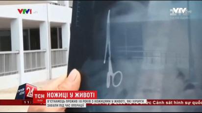 Вьетнамские хирурги вытащили из мужчины ножницы, которые сами же там забыли 18 лет назад