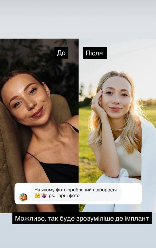 Сториз Катерини Реп’яхової / © instagram.com/repyahovakate