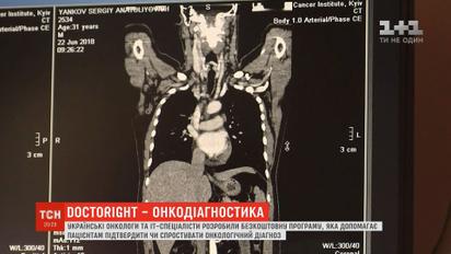 Українські онкологи та ІТ-спеціалісти розробили програму, яка допомагає визначити онкодіагноз