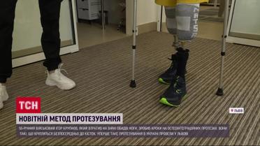 Протез прикріпили до кісток - таку унікальну операцію зробили вперше в Україні