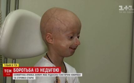 Украинские медики провели уникальную операцию девочке, организм которой стремительно постарел до 60-летнего возраста