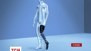 В Ісландії винайшли біонічні протези, які можна контролювати силою думки