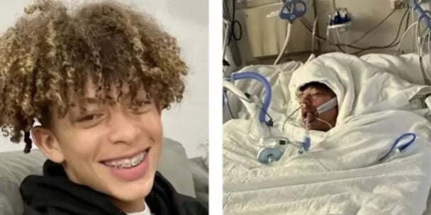 Мейсон Дарк пробуде в опіковому відділенні пів року / Фото: gofundme.com