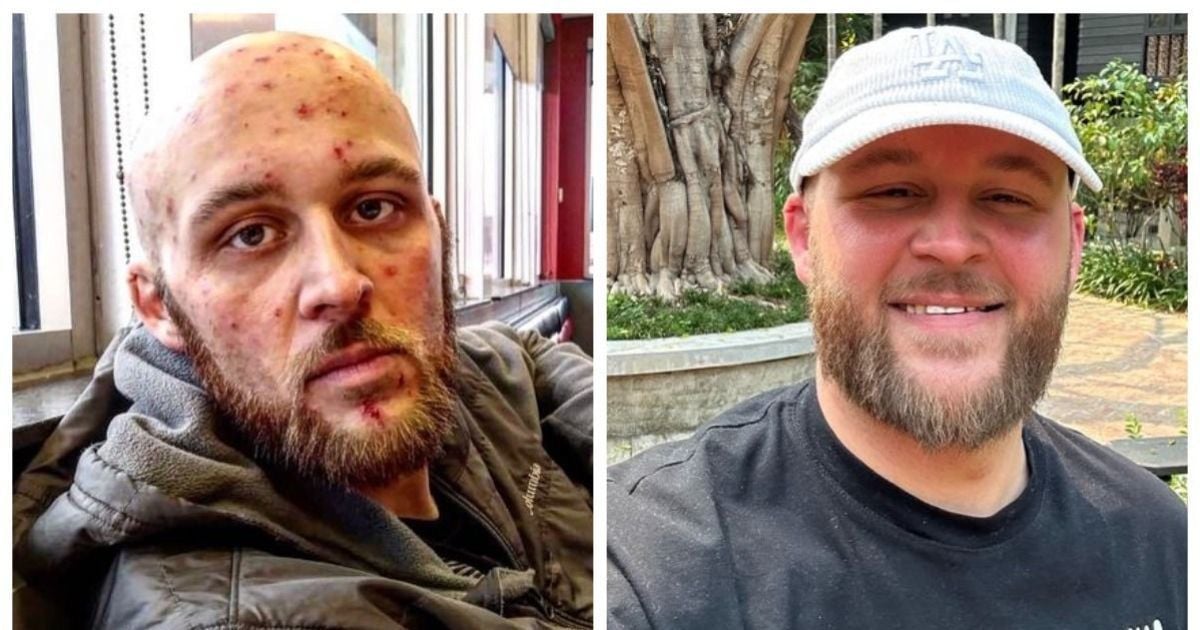 Гантер Шепард під час і після наркотичної залежності