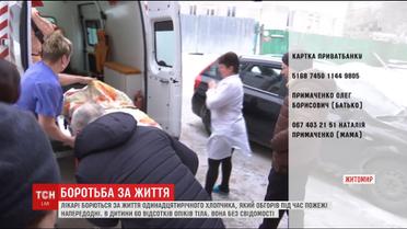 Лікарі розповіли про стан хлопчика, який обгорів під час пожежі на Житомирщині