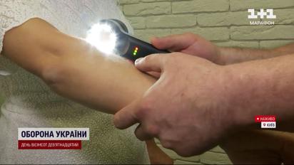 Перевірте свої родимки, бо меланома - найагресивніший вид раку шкіри