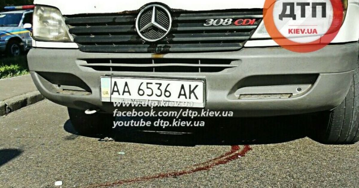 Пострадавший попал в реанимацию / © dtp.kiev.ua
