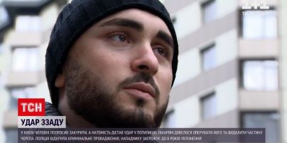 Новости Украины: в столице мужчина получил по голове после того, как спросил закурить