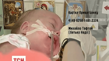 Маленька Надійка Тафтай потребує допомоги