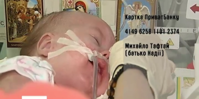 Маленька Надійка Тафтай потребує допомоги