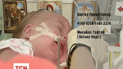 Маленькая Надя Тафтай нуждается в помощи
