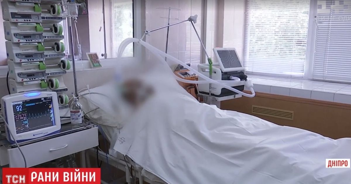 Медики змогли витягти не всі осколки з поранених біля Широкиного бійців