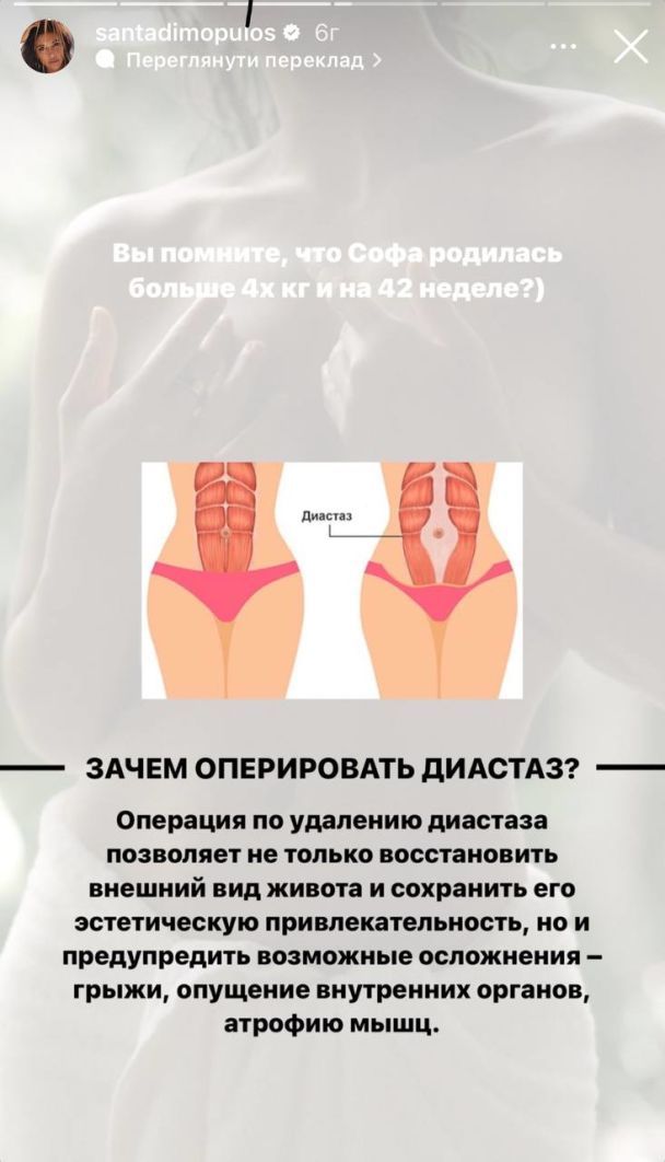 Санта Димопулос готовится к операции / © instagram.com/santadimopulos