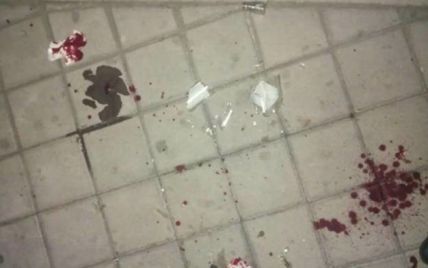 У Києві на Подолі чоловік напав із ножем на працівника кафе