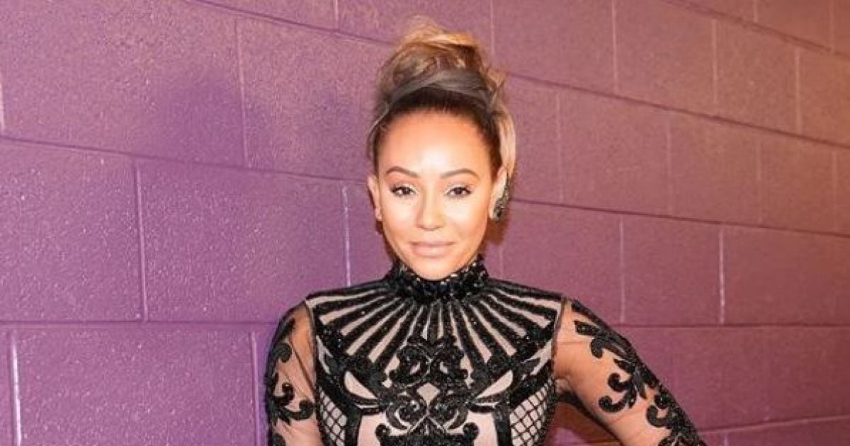 После дорогостоящей подтяжки лица экс-солистка Spice Girls изменилась до неузнаваемости