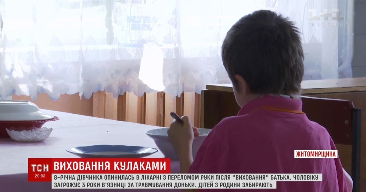 Перелом плеча і гематоми: на Житомирщині батько ледве не до інвалідності побив 8-річну доньку
