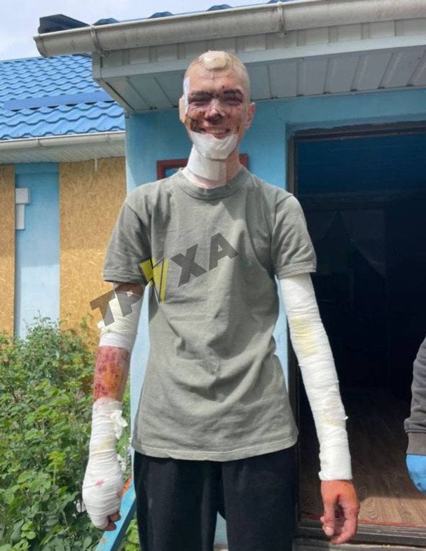 Пострадавший полицейский во время атаки на блокпост на Сумщине / © Труха