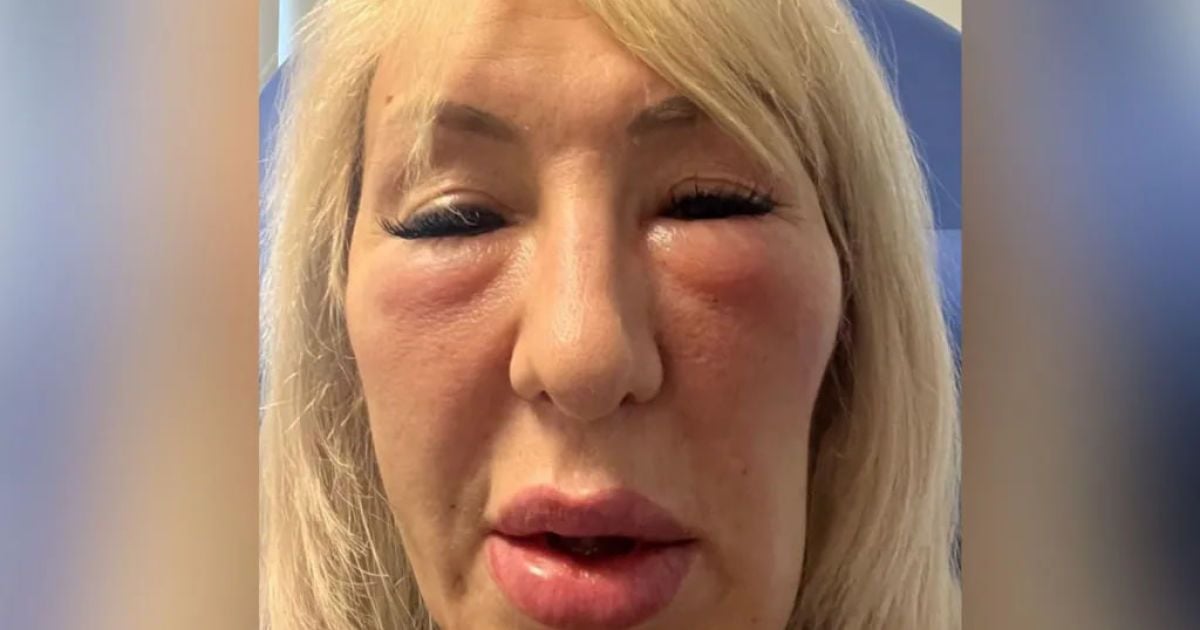 Жінка звинувачує фальшивого лікаря в косметологічних помилках. Фото: Handout