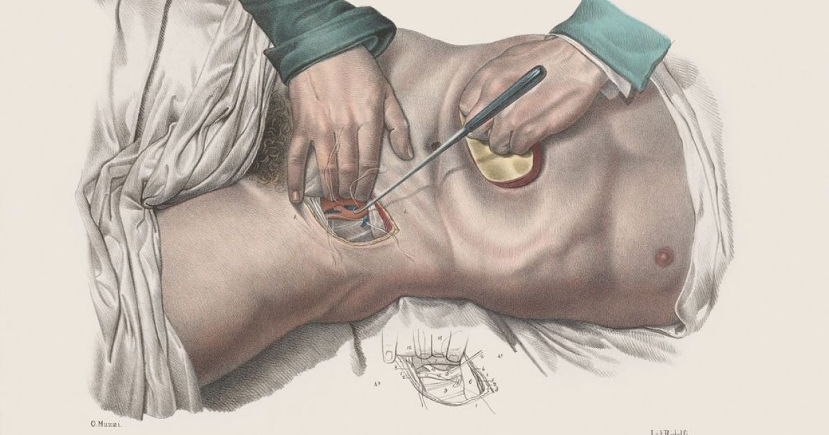 Хірургія 19-го століття. / © thamesandhudson.com