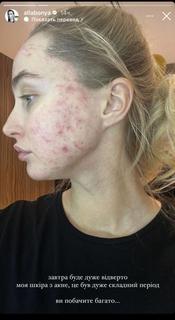 Алла Барановська, дружина Миколи Тищенка / © instagram.com/allabonya